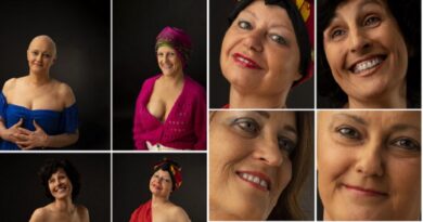 Arriva in edicola “#CCW Calendar Cancer Woman”, dove il dolore si fa bellezza